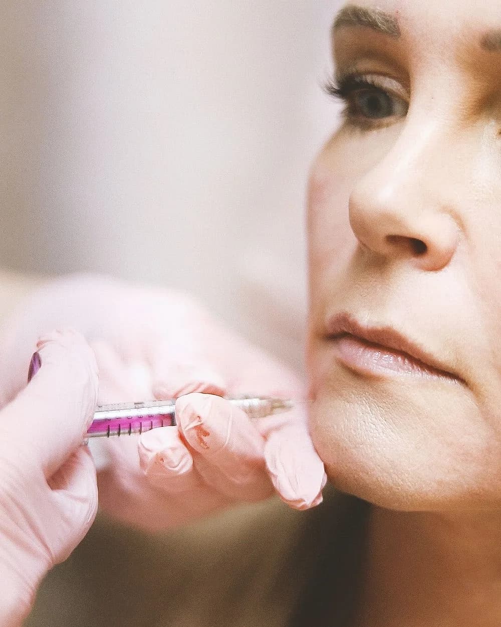 A clinician injecting a patient near the mouth during a cosmetic treatment.