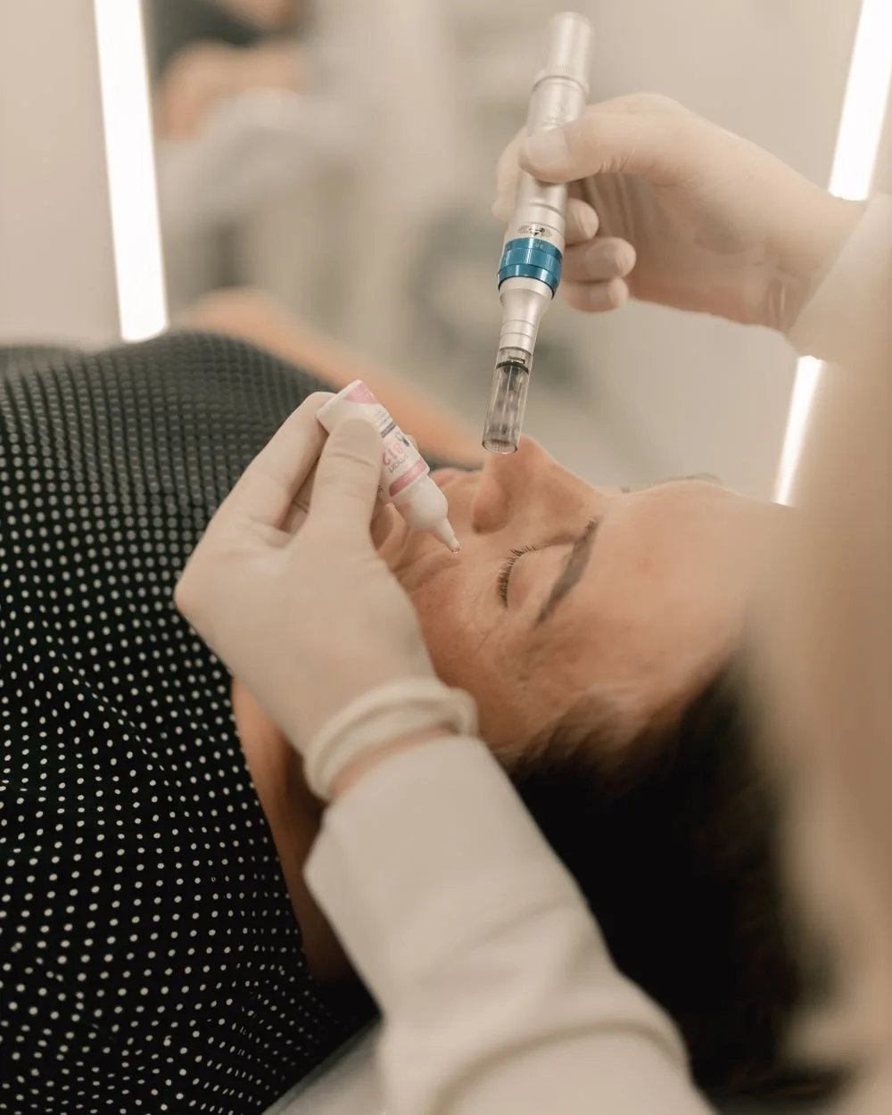 A clinician performing microneedling on a patient’s face with a microneedling pen.